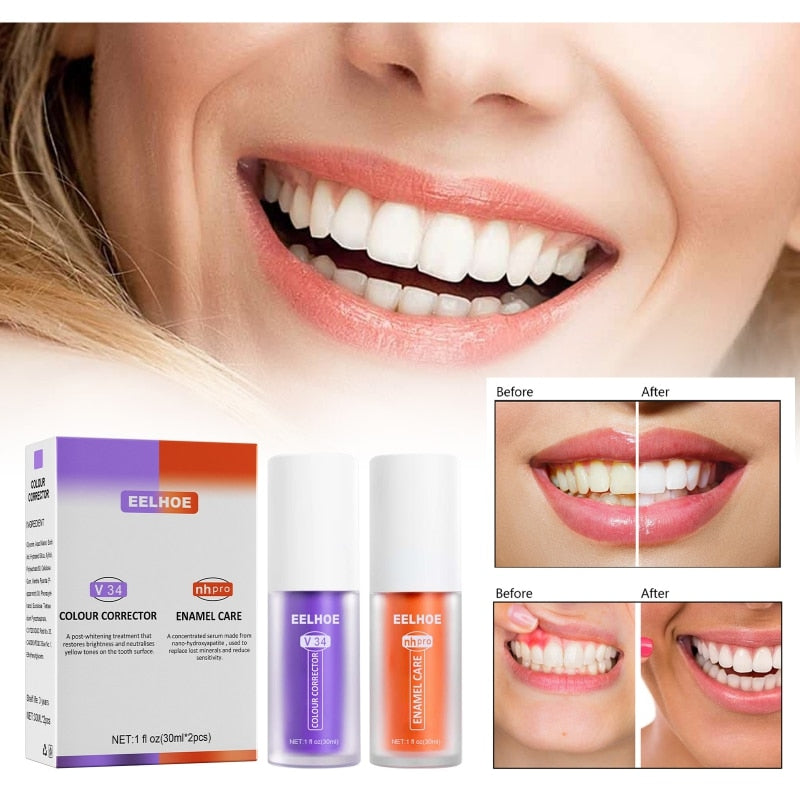 The Purple Touch™  V34 Purple Toothpaste Teeth Whitener